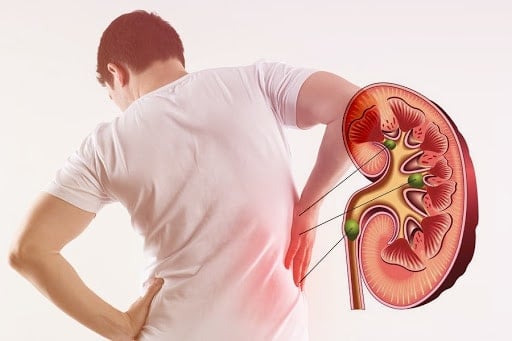 Bệnh thận có thể dẫn đến tăng ure trong máu