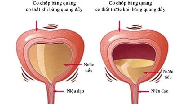 Vai trò lưu trữ và tống xuất nước tiểu của bàng quang