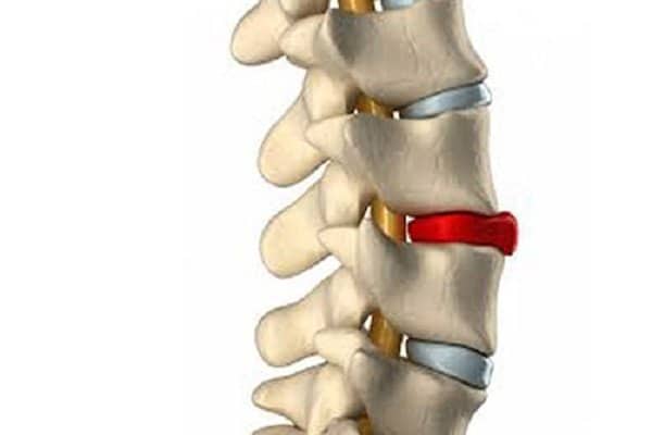 chức năng đĩa đệm cột sống
