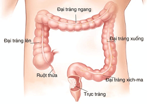 Cấu tạo ruột già