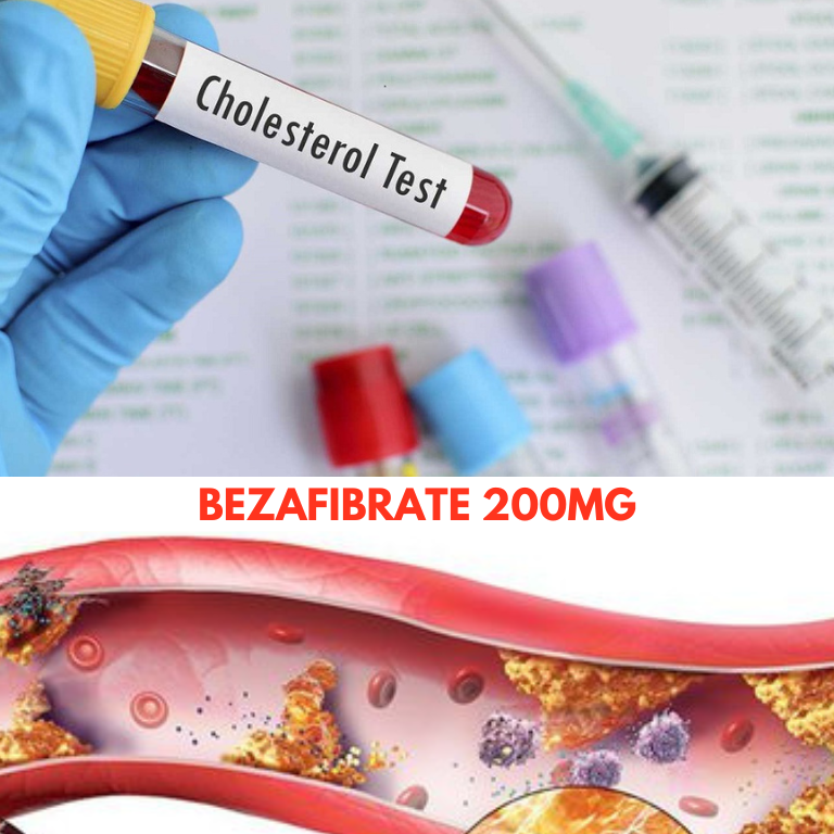 benzafibrat