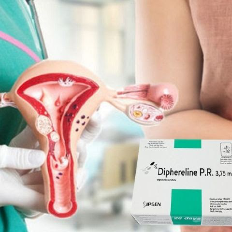 diphereline