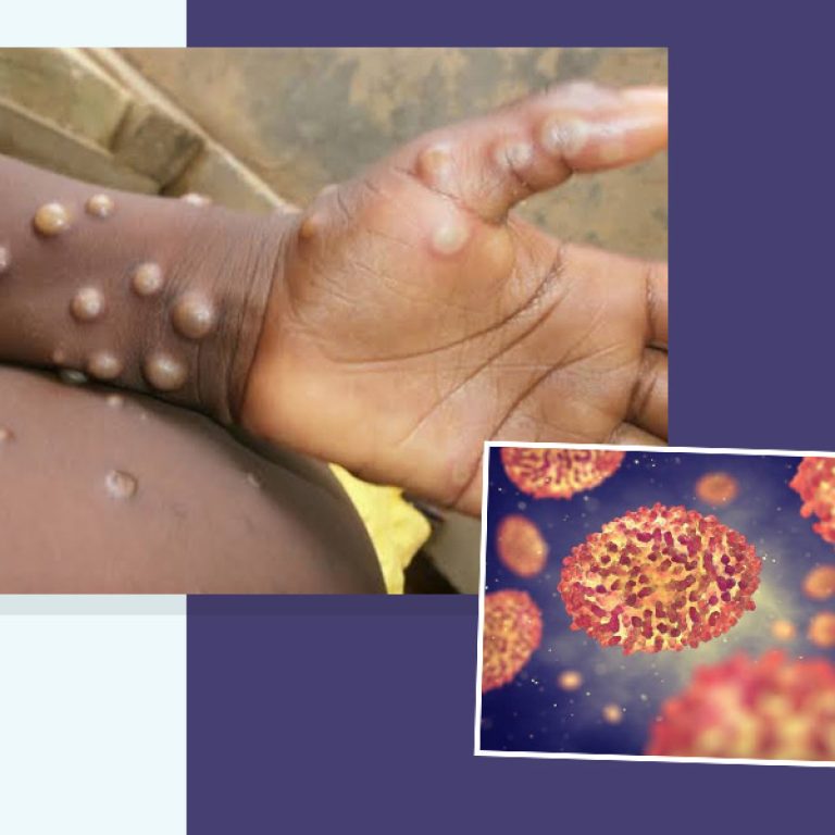 pic.monkeypox